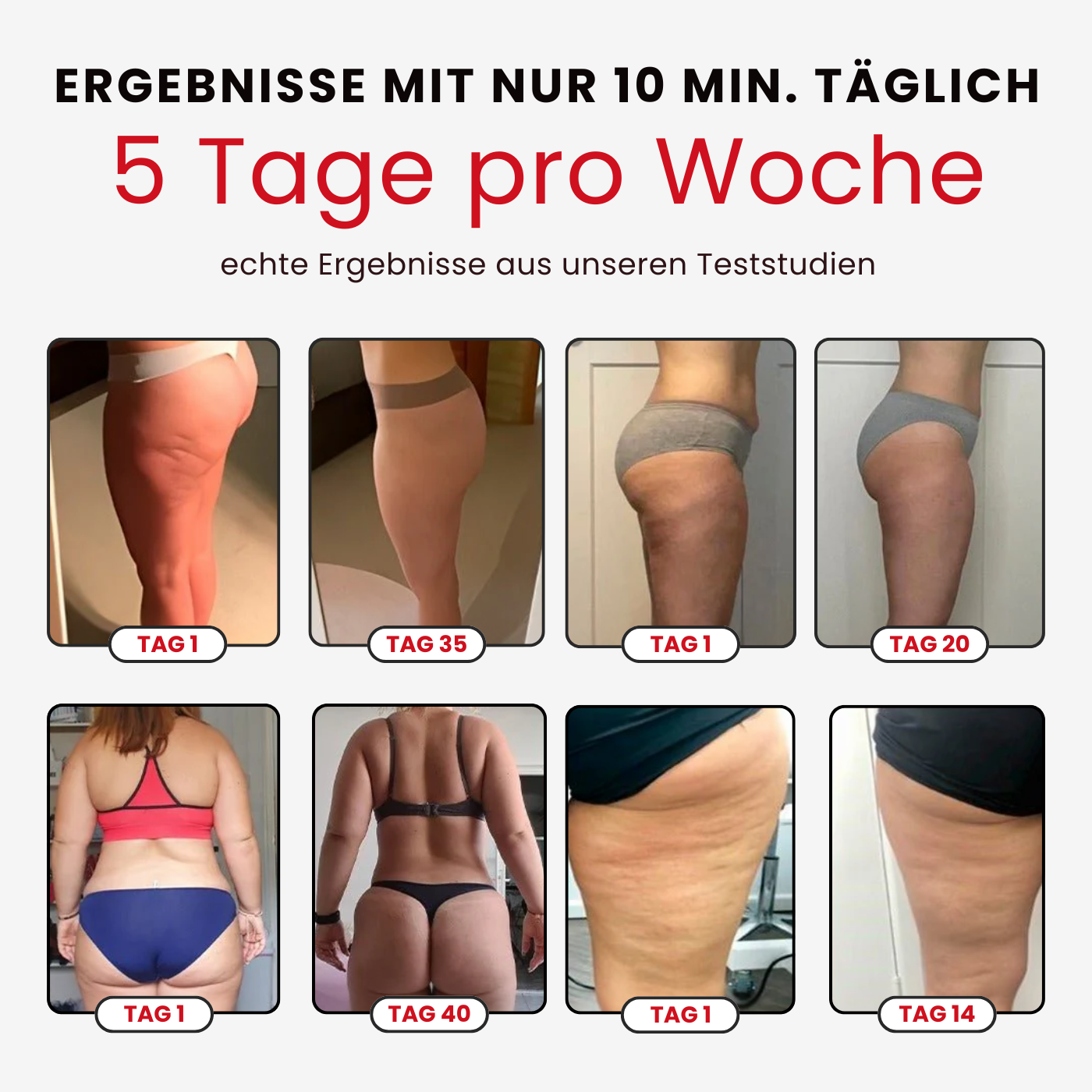 RELAXI Smart Schröpfset für Cellulite