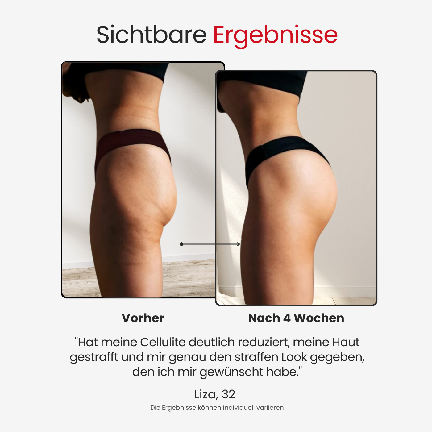 RELAXI Smart Schröpfset für Cellulite